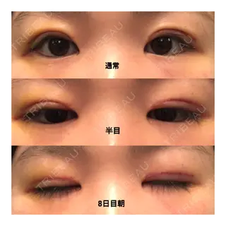 8日目の経過画像（1枚目）
