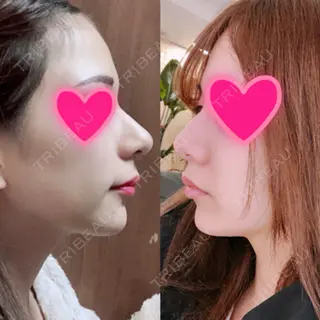 8日目の経過画像（3枚目）