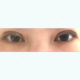 10日目の経過画像（1枚目）