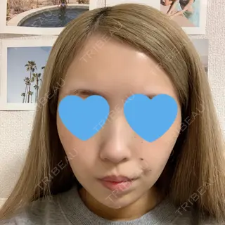 3日目の経過画像（1枚目）