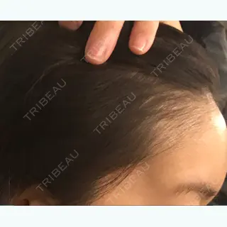 1日目の経過画像（1枚目）