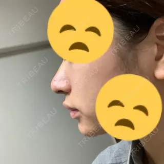 3日目の経過画像（2枚目）