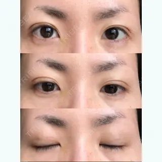19日目の経過画像（1枚目）