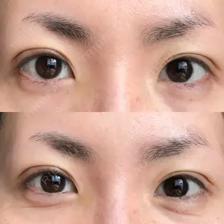 19日目の経過画像（3枚目）