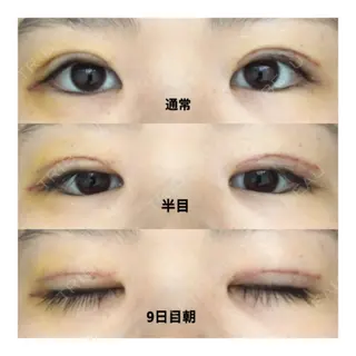 9日目の経過画像（1枚目）
