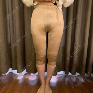 0日目の経過画像（1枚目）