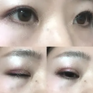 39日目の経過画像（1枚目）