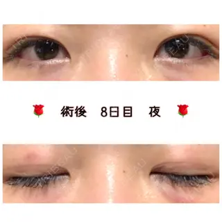 9日目の経過画像（1枚目）