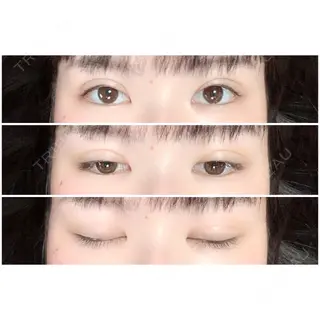 6日目の経過画像（1枚目）