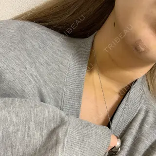 4日目の経過画像（1枚目）