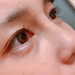 181日目の経過画像（2枚目）