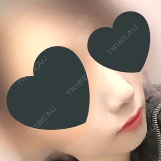 18日目の経過画像（1枚目）