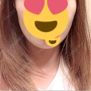 5日目の経過画像（1枚目）