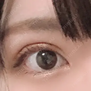 9日目の経過画像（1枚目）