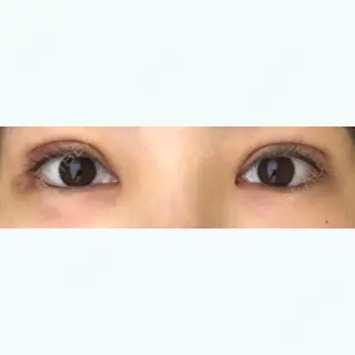 7日目の経過画像（1枚目）