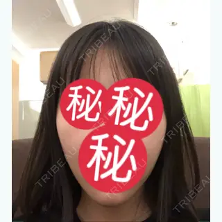 54日目の経過画像（1枚目）