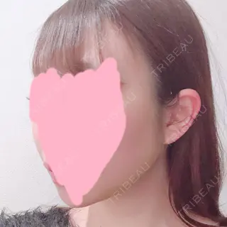 6日目の経過画像（3枚目）