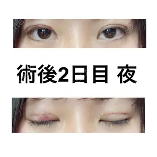2日目の経過画像（2枚目）