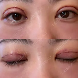 4日目の経過画像（1枚目）