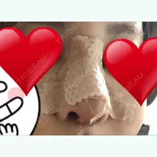 5日目の経過画像（1枚目）