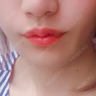 10日目の経過画像（2枚目）