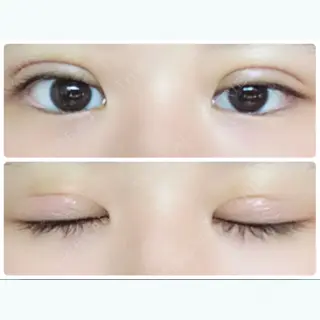 4日目の経過画像（1枚目）