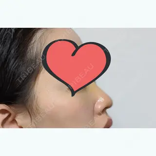 3日目の経過画像（2枚目）