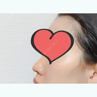 3日目の経過画像（3枚目）