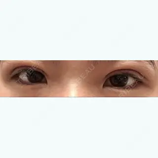 1日目の経過画像（1枚目）