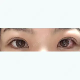 22日目の経過画像（1枚目）