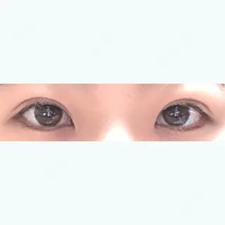 46日目の経過画像（1枚目）