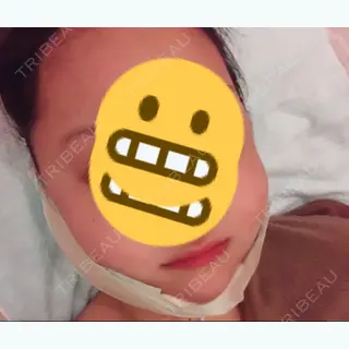 21日目の経過画像（1枚目）
