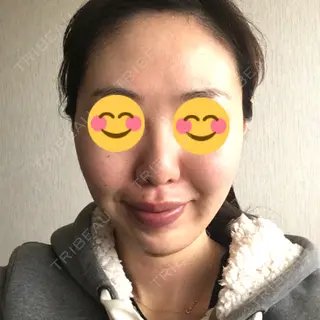 2日目の経過画像（2枚目）