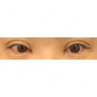 9日目の経過画像（1枚目）