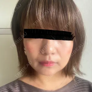 12日目の経過画像（1枚目）