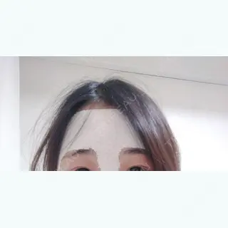 5日目の経過画像（1枚目）