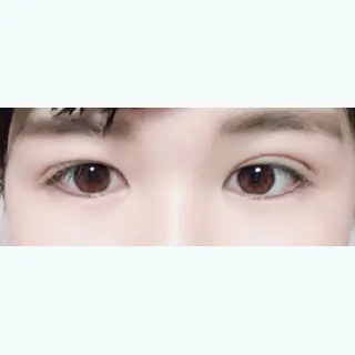 11日目の経過画像（1枚目）