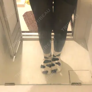 2日目の経過画像（1枚目）
