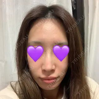 12日目の経過画像（1枚目）