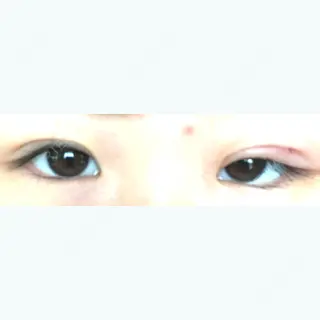 12日目の経過画像（1枚目）