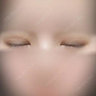 2日目の経過画像（2枚目）