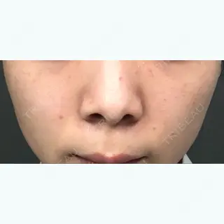 10日目の経過画像（1枚目）
