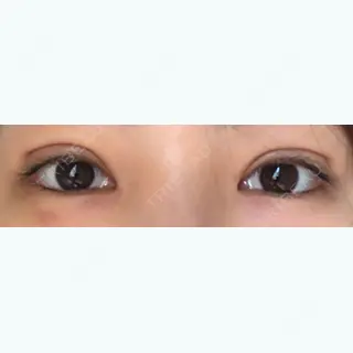 12日目の経過画像（1枚目）