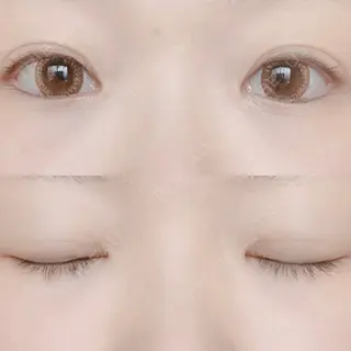 78日目の経過画像（1枚目）
