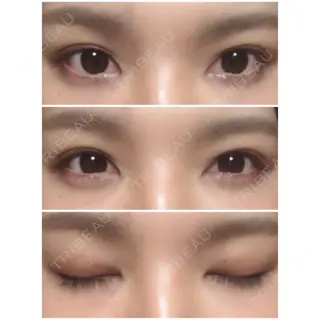 20日目の経過画像（1枚目）