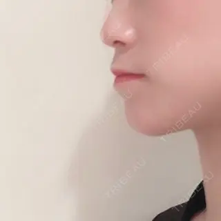 1日目の経過画像（1枚目）