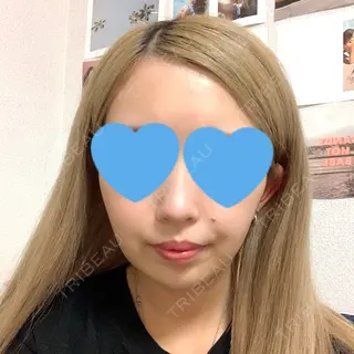 11日目の経過画像（1枚目）