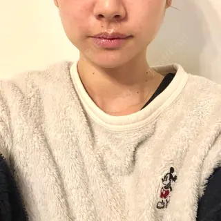 6日目の経過画像（1枚目）