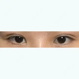 17日目の経過画像（1枚目）