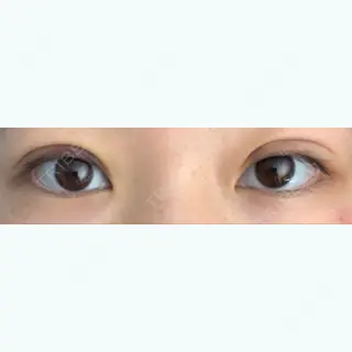 2日目の経過画像（1枚目）